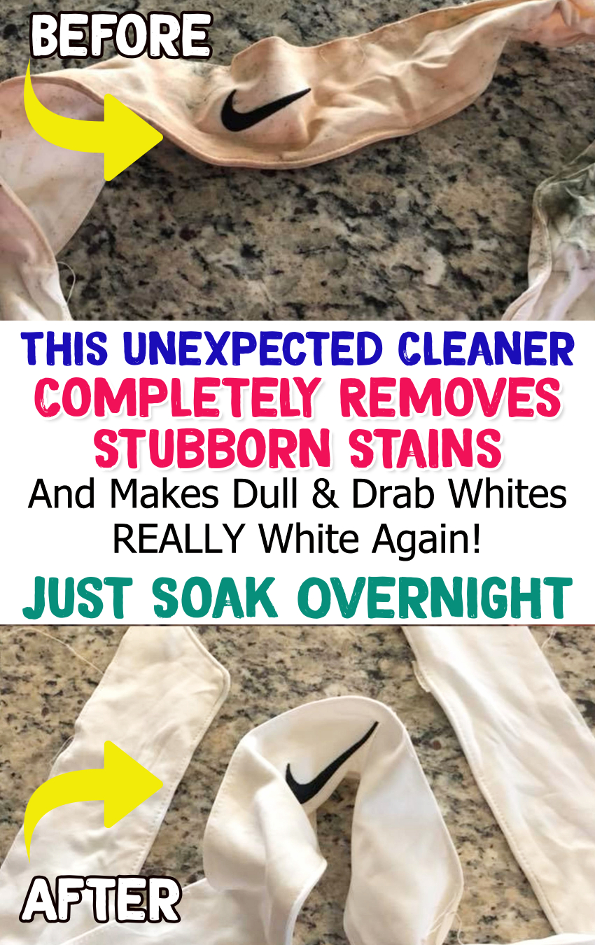 Laundry Hack!  Brilliant stain removal tips for getting whites REALLY white again!  #cleaningtips #lifehacks #momhacks